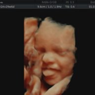 4d scan at 30 weeks